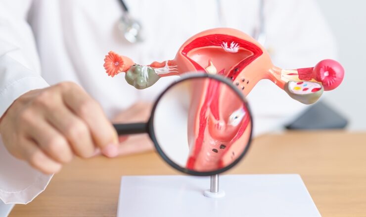 Doctor,With,Uterus,And,Ovaries,Anatomy,Model,And,Magnifying,Glass.